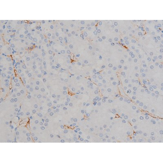 HSP90AB1 / HSP90 Alpha B1 Antibody - 1:200 staining rat kidney tissue by IHC-P. The tissue was formaldehyde fixed and a heat mediated antigen retrieval step in citrate buffer was performed. The tissue was then blocked and incubated with the antibody for 1.5 hours at 22°C. An HRP conjugated goat anti-rabbit antibody was used as the secondary.