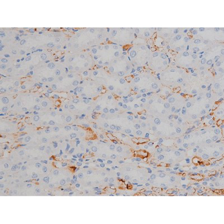 HSP90AB1 / HSP90 Alpha B1 Antibody - 1:200 staining rat kidney tissue by IHC-P. The tissue was formaldehyde fixed and a heat mediated antigen retrieval step in citrate buffer was performed. The tissue was then blocked and incubated with the antibody for 1.5 hours at 22°C. An HRP conjugated goat anti-rabbit antibody was used as the secondary.