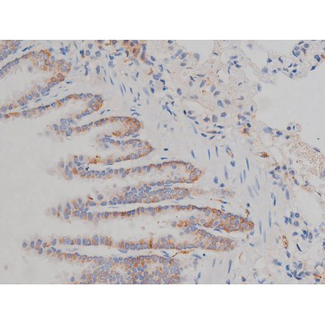 HSP90AB1 / HSP90 Alpha B1 Antibody - 1:200 staining rat lung tissue by IHC-P. The tissue was formaldehyde fixed and a heat mediated antigen retrieval step in citrate buffer was performed. The tissue was then blocked and incubated with the antibody for 1.5 hours at 22°C. An HRP conjugated goat anti-rabbit antibody was used as the secondary.