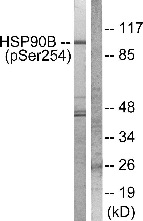 HSP90AB1 / HSP90 Alpha B1 Antibody - Western blot analysis of extracts from Hela cells treated with TNF-a (20ng/ml, 30mins), using HSP90B (phospho-Ser254) antibody.
