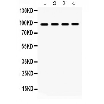 HSP90B1 / GP96 / GRP94 Antibody - GRP94 antibody Western blot. All lanes: Anti GRP94 at 0.5 ug/ml. Lane 1: Rat Liver Tissue Lysate at 50 ug. Lane 2: A375 Whole Cell Lysate at 40 ug. Lane 3: HELA Whole Cell Lysate at 40 ug. Lane 4: NIH3T3 Whole Cell Lysate at 40 ug. Predicted band size: 92 kD. Observed band size: 92 kD.
