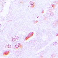 HSP90B1 / GP96 / GRP94 Antibody - Immunohistochemical analysis of GRP94 staining in human brain formalin fixed paraffin embedded tissue section. The section was pre-treated using heat mediated antigen retrieval with sodium citrate buffer (pH 6.0). The section was then incubated with the antibody at room temperature and detected using an HRP conjugated compact polymer system. DAB was used as the chromogen. The section was then counterstained with hematoxylin and mounted with DPX.