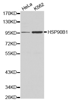 HSP90B1 / GP96 / GRP94 Antibody - Western blot analysis of Hela cell and K562 cell lysate.