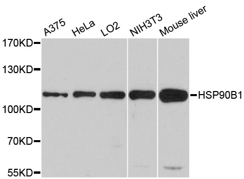HSP90B1 / GP96 / GRP94 Antibody - Western blot analysis of extracts of various cell lines, using HSP90B1 antibody at 1:1000 dilution. The secondary antibody used was an HRP Goat Anti-Rabbit IgG (H+L) at 1:10000 dilution. Lysates were loaded 25ug per lane and 3% nonfat dry milk in TBST was used for blocking. An ECL Kit was used for detection and the exposure time was 90s.