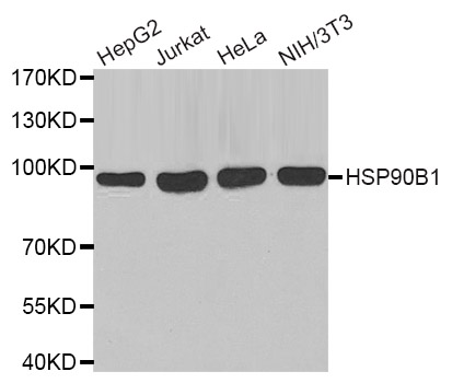 HSP90B1 / GP96 / GRP94 Antibody - Western blot analysis of extracts of various cell lines, using HSP90B1 antibody.