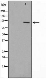 HSP90B1 / GP96 / GRP94 Antibody - Western blot of SKOV3 cell lysate using GRP94 Antibody