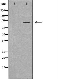 HSP90B1 / GP96 / GRP94 Antibody - Western blot analysis of HeLa cells using HSP90B1 antibody. The lane on the left is treated with the antigen-specific peptide.