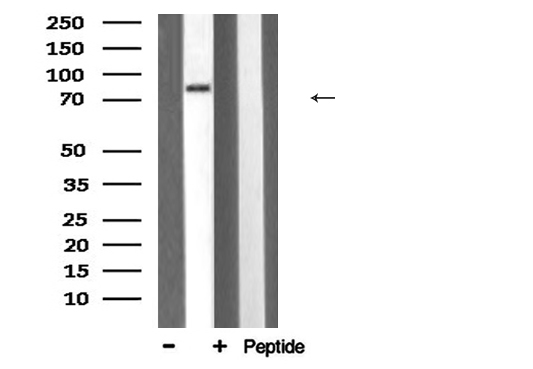 HSP90B1 / GP96 / GRP94 Antibody - Western blot analysis of HSP90B1 expression in rat muscle lysate