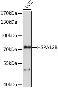 HSPA12B Antibody - Western blot analysis of extracts of LO2 cells, using HSPA12B antibody at 1:1000 dilution. The secondary antibody used was an HRP Goat Anti-Rabbit IgG (H+L) at 1:10000 dilution. Lysates were loaded 25ug per lane and 3% nonfat dry milk in TBST was used for blocking. An ECL Kit was used for detection and the exposure time was 90s.