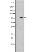 HSPA12B Antibody - Western blot analysis of HSPA12B expression in SiHa cells line lysates. The lane on the left is treated with the antigen-specific peptide.