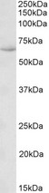 HSPA13 Antibody - HSPA13 antibody (0.1 ug/ml) staining of Human Uterus lysate (35 ug protein in RIPA buffer). Primary incubation was 1 hour. Detected by chemiluminescence.