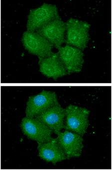 HSPA13 Antibody - ICC/IF analysis of HSPA13 in Hep3B cells. The cell was stained with HSPA13 antibody (1:100).The secondary antibody (green) was used Alexa Fluor 488. DAPI was stained the cell nucleus (blue).