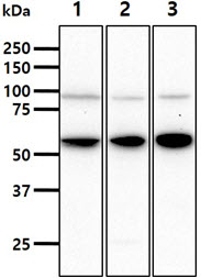 HSPA13 Antibody - The cell lysates (40ug) were resolved by SDS-PAGE, transferred to PVDF membrane and probed with anti-human HSPA13 antibody (1:1000). Proteins were visualized using a goat anti-mouse secondary antibody conjugated to HRP and an ECL detection system. Lane 1.: 293T cell lysate Lane 2.: K562 cell lysate Lane 3.: MCF7 cell lysate