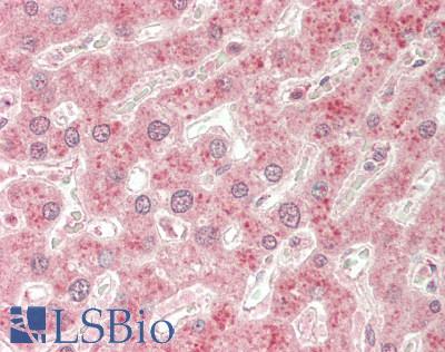 HSPA13 Antibody - Human Liver: Formalin-Fixed, Paraffin-Embedded (FFPE).  This image was taken for the unconjugated form of this product. Other forms have not been tested.