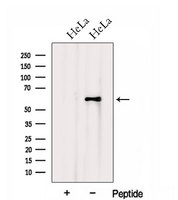 HSPA13 Antibody - Western blot analysis of extracts of HeLa cells using HSPA13 antibody. The lane on the left was treated with blocking peptide.