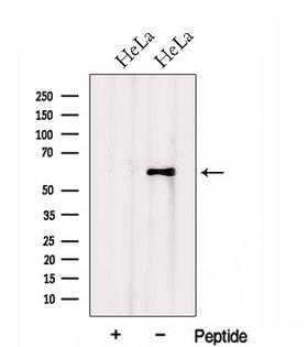 HSPA13 Antibody - Western blot analysis of extracts of HeLa cells using HSPA13 antibody. The lane on the left was treated with blocking peptide.