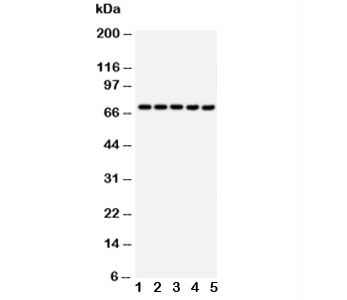 HSPA1A Antibody - Western blot testing of HSP70 antibody and Lane 1: 293T; 2: HeLa; 3: A549; 4: A431; 5: PANC cell lysate