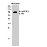 HSPA1A Antibody - Western blot of Acetyl-HSP70 (K246) antibody