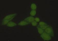 HSPA1A Antibody - Immunocytochemistry stain of HeLa using Hsp70 (N-terminus) mouse monoclonal antibody (1:300).