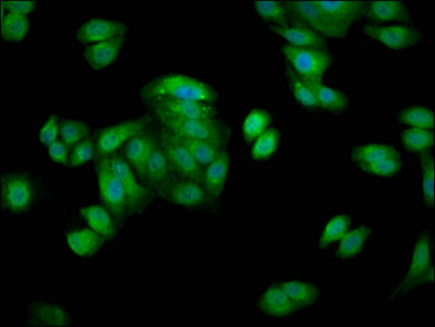 HSPA1A Antibody - Immunofluorescence staining of HepG2 cells with HSPA1A Antibody at 1:66, counter-stained with DAPI. The cells were fixed in 4% formaldehyde, permeabilized using 0.2% Triton X-100 and blocked in 10% normal Goat Serum. The cells were then incubated with the antibody overnight at 4°C. The secondary antibody was Alexa Fluor 488-congugated AffiniPure Goat Anti-Rabbit IgG(H+L).