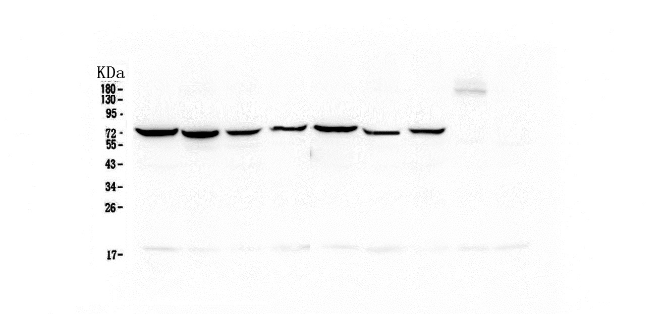 HSPA1A Antibody - Western blot analysis of Hsp70 using anti-Hsp70 antibody. Electrophoresis was performed on a 5-20% SDS-PAGE gel at 70V (Stacking gel) / 90V (Resolving gel) for 2-3 hours. The sample well of each lane was loaded with 50ug of sample under reducing conditions. Lane 1: human Hela whole cell lysate,Lane 2: human COLO-320 whole cell lysate,Lane 3: human SW620 whole cell lysate,Lane 4: human A431 whole cell lysate,Lane 5: human A549 whole cell lysate,Lane 6: human HepG2 whole cell lysate,Lane 7: human PANC-1 whole cell lysate. After Electrophoresis, proteins were transferred to a Nitrocellulose membrane at 150mA for 50-90 minutes. Blocked the membrane with 5% Non-fat Milk/ TBS for 1.5 hour at RT. The membrane was incubated with mouse anti-Hsp70 antigen affinity purified monoclonal antibody at 0.5 µg/mL overnight at 4°C, then washed with TBS-0.1% Tween 3 times with 5 minutes each and probed with a goat anti-mouse IgG-HRP secondary antibody at a dilution of 1:10000 for 1.5 hour at RT. The signal is developed using an Enhanced Chemiluminescent detection (ECL) kit with Tanon 5200 system.