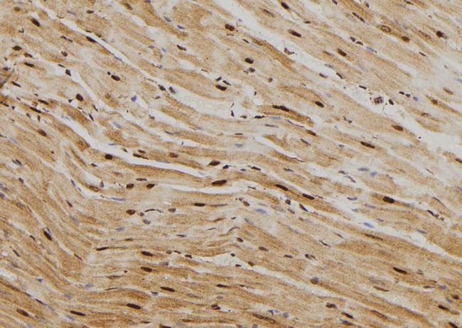 HSPA1A Antibody - 1:100 staining rat heart tissue by IHC-P. The sample was formaldehyde fixed and a heat mediated antigen retrieval step in citrate buffer was performed. The sample was then blocked and incubated with the antibody for 1.5 hours at 22°C. An HRP conjugated goat anti-rabbit antibody was used as the secondary.