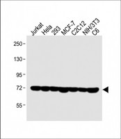 HSPA1A Antibody - All lanes: Anti-HSPA1A/HSPA1B Antibody (Y41) at 1:1000 dilution Lane 1: Jurkat whole cell lysate Lane 2: Hela whole cell lysate Lane 3: 293 whole cell lysate Lane 4: MCF-7 whole cell lysate Lane 5: C2C12 whole cell lysate Lane 6: NIH/3T3 whole cell lysate Lane 7: C6 whole cell lysate Lysates/proteins at 20 µg per lane. Secondary Goat Anti-Rabbit IgG, (H+L), Peroxidase conjugated at 1/10000 dilution. Predicted band size: 70 kDa Blocking/Dilution buffer: 5% NFDM/TBST.