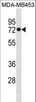 HSPA1L Antibody - HSPA1L Antibody western blot of MDA-MB453 cell line lysates (35 ug/lane). The HSPA1L antibody detected the HSPA1L protein (arrow).