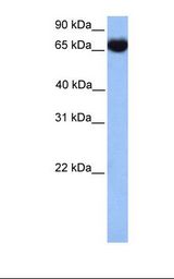 HSPA1L Antibody - Jurkat cell lysate. Antibody concentration: 1.0 ug/ml. Gel concentration: 12%.  This image was taken for the unconjugated form of this product. Other forms have not been tested.