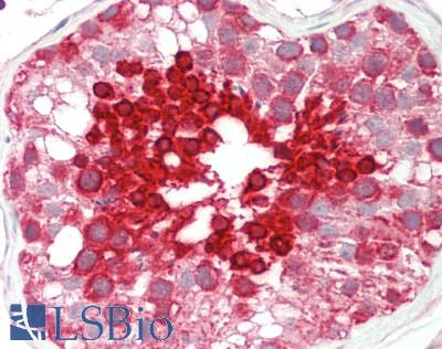 HSPA1L Antibody - Human Testis: Formalin-Fixed, Paraffin-Embedded (FFPE).  This image was taken for the unconjugated form of this product. Other forms have not been tested.