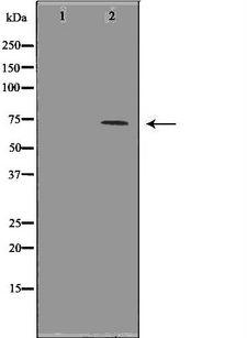 HSPA1L Antibody - Western blot analysis of HeLa whole cells lysates using HSPA1L antibody. The lane on the left is treated with the antigen-specific peptide.