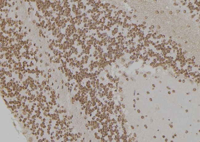 HSPA1L Antibody - 1:100 staining rat brain tissue by IHC-P. The sample was formaldehyde fixed and a heat mediated antigen retrieval step in citrate buffer was performed. The sample was then blocked and incubated with the antibody for 1.5 hours at 22°C. An HRP conjugated goat anti-rabbit antibody was used as the secondary.