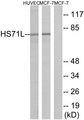 HSPA1L Antibody - Western blot analysis of extracts from HUVEC cells and MCF-7 cells, using HS71L antibody.