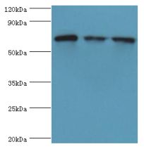 HSPA2 Antibody - Western blot. All lanes: HSPA2 antibody at 6 ug/ml. Lane 1: A431 whole cell lysate. Lane 2: HeLa whole cell lysate. Lane 3: Rat brain tissue. Secondary antibody: Goat polyclonal to rabbit at 1:10000 dilution. Predicted band size: 70 kDa. Observed band size: 70 kDa.