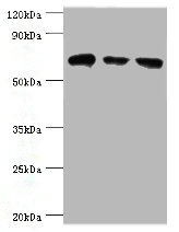 HSPA2 Antibody - Western blot All lanes: HSPA2 antibody at 6µg/ml Lane 1: A431 whole cell lysate Lane 2: Hela whole cell lysate Lane 3: Rat brain tissue Secondary Goat polyclonal to rabbit IgG at 1/10000 dilution Predicted band size: 70 kDa Observed band size: 70 kDa