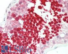 HSPA2 Antibody - Human Testis: Formalin-Fixed, Paraffin-Embedded (FFPE).  This image was taken for the unconjugated form of this product. Other forms have not been tested.
