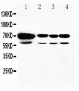 HSPA2 Antibody - WB of HSPA2 antibody. All lanes: Anti-HSPA2 at 0.5ug/ml. Lane 1: Rat Testis Tissue Lysate at 40ug. Lane 2: A549 Whole Cell Lysate at 40ug. Lane 3: MCF-7 Whole Cell Lysate at 40ug. Lane 4: HELA Whole Cell Lysate at 40ug. Predicted bind size: 70KD. Observed bind size: 70KD.