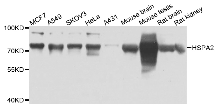 HSPA2 Antibody - Western blot analysis of extracts of various cells.