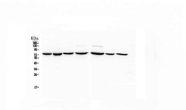 HSPA2 Antibody - Western blot analysis of HSPA2 using anti-HSPA2 antibody. Electrophoresis was performed on a 5-20% SDS-PAGE gel at 70V (Stacking gel) / 90V (Resolving gel) for 2-3 hours. The sample well of each lane was loaded with 50ug of sample under reducing conditions. Lane 1: human Hela whole cell lysate, Lane 2: human MDA-MB-231 whole cell lysate,Lane 3: human COLO-320 whole cell lysate,Lane 4: human PANC-1 whole cell lysate. Lane 5: human HT1080 whole cell lysate,Lane 6: human MDA-MB-453 whole cell lysate,Lane 7: human HepG2 whole cell lysate. After Electrophoresis, proteins were transferred to a Nitrocellulose membrane at 150mA for 50-90 minutes. Blocked the membrane with 5% Non-fat Milk/ TBS for 1.5 hour at RT. The membrane was incubated with mouse anti-HSPA2 antigen affinity purified monoclonal antibody at 0.5 µg/mL overnight at 4°C, then washed with TBS-0.1% Tween 3 times with 5 minutes each and probed with a goat anti-mouse IgG-HRP secondary antibody at a dilution of 1:10000 for 1.5 hour at RT. The signal is developed using an Enhanced Chemiluminescent detection (ECL) kit with Tanon 5200 system.