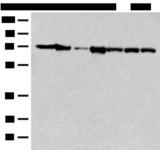 HSPA2 Antibody - Western blot analysis of Mouse brain tissue Human cerebrum tissue NIH/3T3 cell A549 cell Jurkat cell Hela cell and 231 cell lysates  using HSPA2 Polyclonal Antibody at dilution of 1:250
