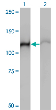 HSPA4 / APG-2 Antibody - Western Blot analysis of HSPA4 expression in transfected 293T cell line by HSPA4 monoclonal antibody (M01), clone 3A11.Lane 1: HSPA4 transfected lysate(94.3 KDa).Lane 2: Non-transfected lysate.