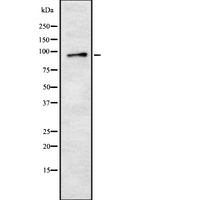 HSPA4 / APG-2 Antibody - Western blot analysis of HSP74 using HepG2 whole cells lysates