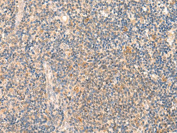 HSPA4L / APG-1 Antibody - Immunohistochemistry of paraffin-embedded Human tonsil tissue  using HSPA4L Polyclonal Antibody at dilution of 1:30(×200)