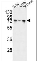 HSPA5 / GRP78 / BiP Antibody - HSPA5 Antibody western blot of HeLa,A2058,NCI-H460 cell line lysates (35 ug/lane). The HSPA5 antibody detected the HSPA5 protein (arrow).