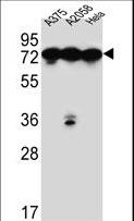 HSPA5 / GRP78 / BiP Antibody - HSPA5 Antibody western blot of A375,A2058,HeLa cell line lysates (35 ug/lane). The HSPA5 antibody detected the HSPA5 protein (arrow).