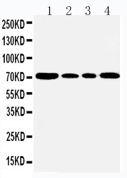 HSPA5 / GRP78 / BiP Antibody - WB of HSPA5 / GRP78 / BIP antibody. All lanes: Anti-HSPA5 at 0.5ug/ml. Lane 1: Rat Testis Tissue Lysate at 40ug. Lane 2: A549 Whole Cell Lysate at 40ug. Lane 3: MCF-7 Whole Cell Lysate at 40ug. Lane 4: HELA Whole Cell Lysate at 40ug. Predicted bind size: 72KD. Observed bind size: 72KD.