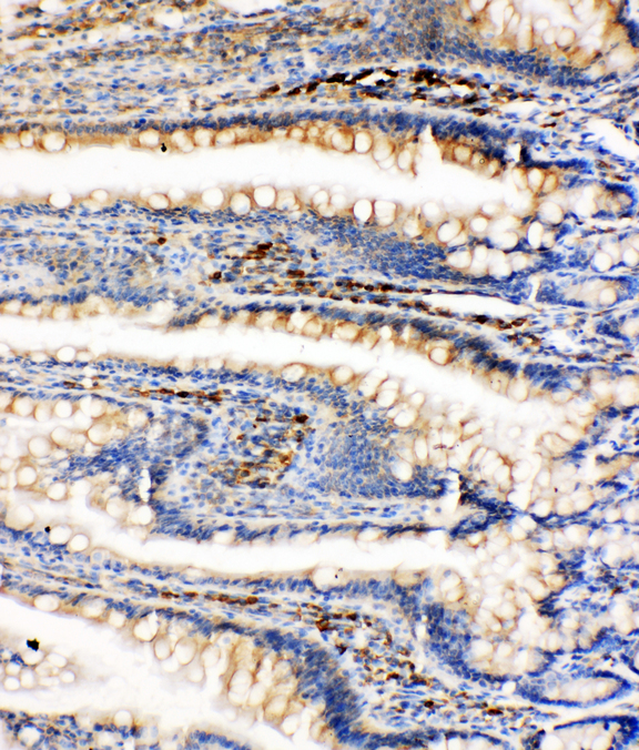 HSPA5 / GRP78 / BiP Antibody - HSPA5 / GRP78 / BIP antibody. IHC(P): Rat Intestine Tissue.