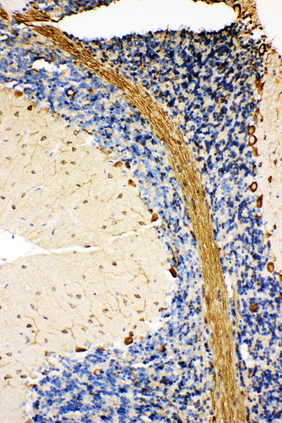 HSPA5 / GRP78 / BiP Antibody - HSPA5 / GRP78 / BIP antibody. IHC(P): Rat Cerebellum Tissue.
