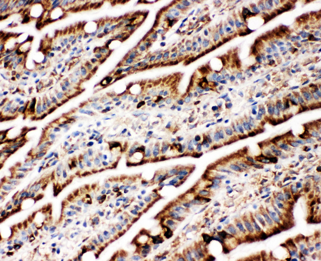 HSPA5 / GRP78 / BiP Antibody - HSPA5 / GRP78 / BIP antibody. IHC(F): Rat Intestine Tissue.