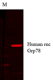 HSPA5 / GRP78 / BiP Antibody -  This image was taken for the unconjugated form of this product. Other forms have not been tested.